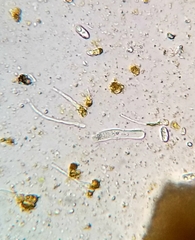 Xanthomendoza montana