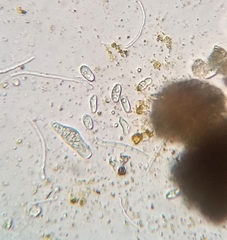 Xanthomendoza montana