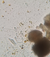 Xanthomendoza montana