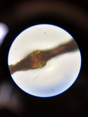 Clastoderma debaryanum