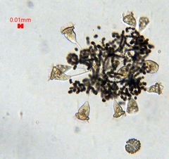 Dolichospermum