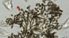 Dolichospermum