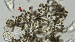 Dolichospermum