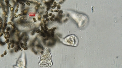 Dolichospermum