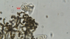 Dolichospermum