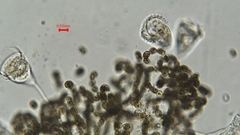 Dolichospermum