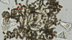 Dolichospermum
