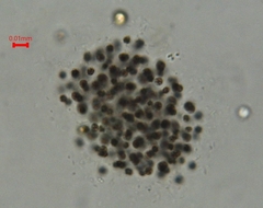 Microcystis