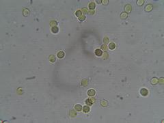 Zhuliangomyces