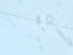 Caloplaca stillicidiorum