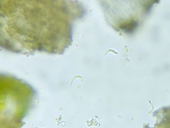 Scoliciosporum umbrinum