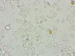 Melanoleuca angelesiana