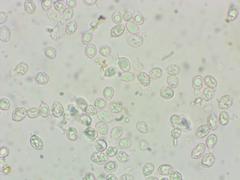 Melanoleuca angelesiana