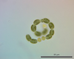 Dolichospermum lemmermannii
