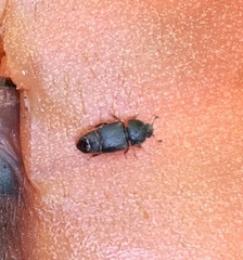 Caplothorax lugubris