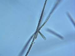 Dolichospermum