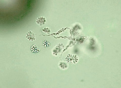 Anthophysa