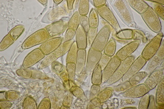 Puccinia malvacearum