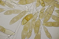 Puccinia malvacearum