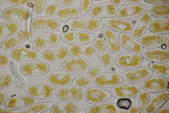 Melampsora allii-populina