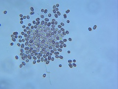 Microcystis