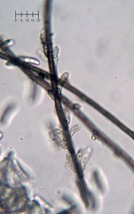 Menispora glauca