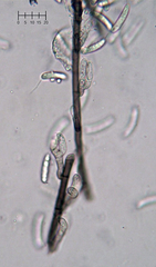 Menispora glauca