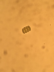 Scenedesmaceae