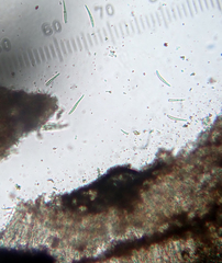 Lecanactis subfarinosa