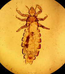 Pediculus humanus