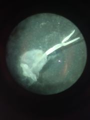 Lernaeidae
