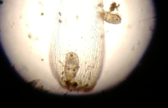 Acariformes