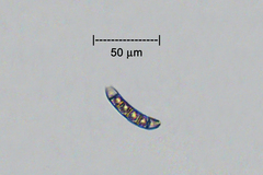 Pleosporaceae