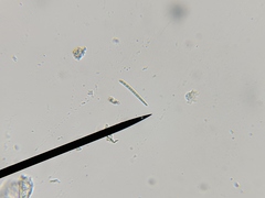 Bacidia rubella