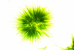 Gloeotrichia echinulata