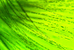 Gloeotrichia echinulata