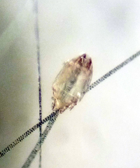 Dermacarus