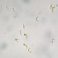 Monoraphidium contortum