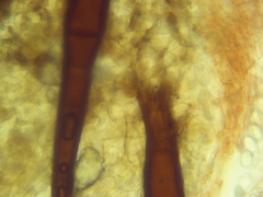 Scutellinia olivascens