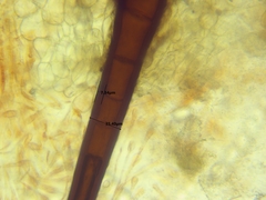 Scutellinia olivascens