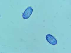 Scutellinia olivascens