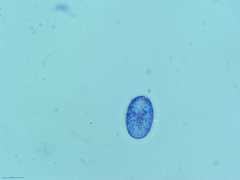 Scutellinia olivascens