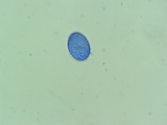 Scutellinia olivascens