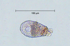 Euglypha strigosa