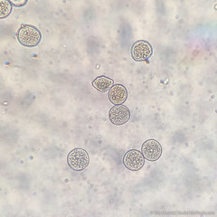 Puccinia cryptandri