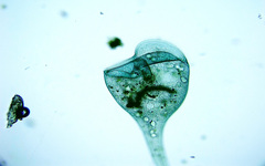 Stentor coeruleus