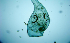 Stentor coeruleus