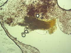 Physarum globuliferum