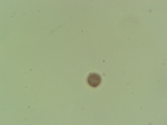 Physarum globuliferum