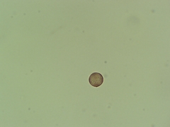 Physarum globuliferum